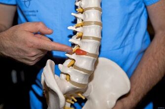 Perché la schiena fa male nella parte bassa della schiena e cosa fare