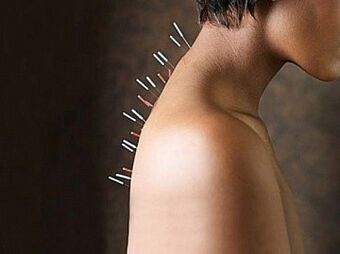 La riflessoterapia è un metodo efficace per trattare l'osteocondrosi cervicale
