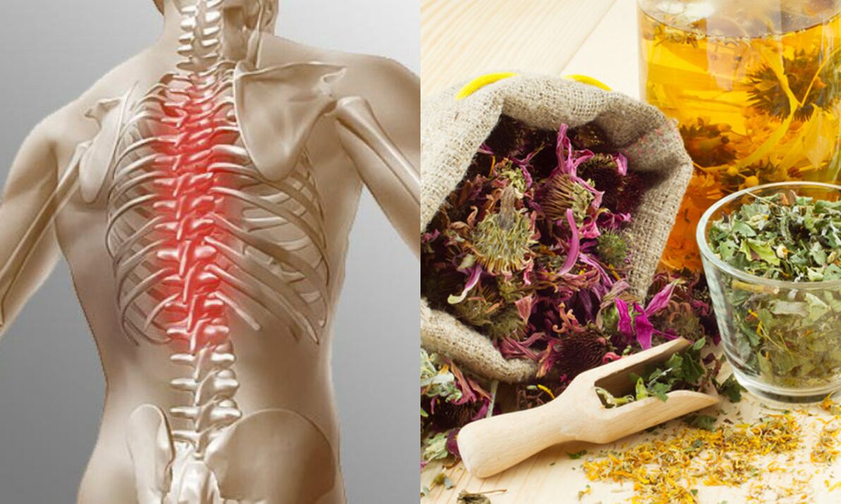 osteocondrosi del collo metodi popolari
