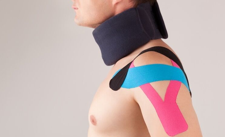 Durante il periodo acuto dell'osteocondrosi cervicale, è necessario indossare un collare speciale