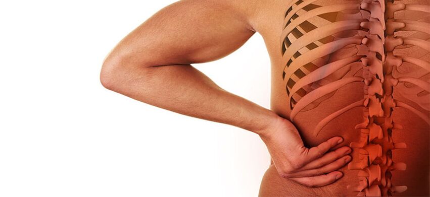 sintomi di osteocondrosi lombare